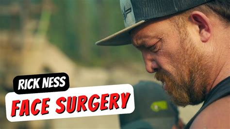 what happen to rick ness|what happened to rick's nose on gold rush.